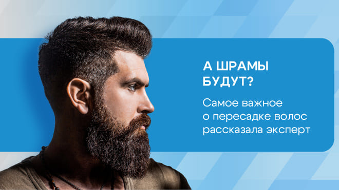 Сколько лет живут пересаженные волосы, остаются ли шрамы?